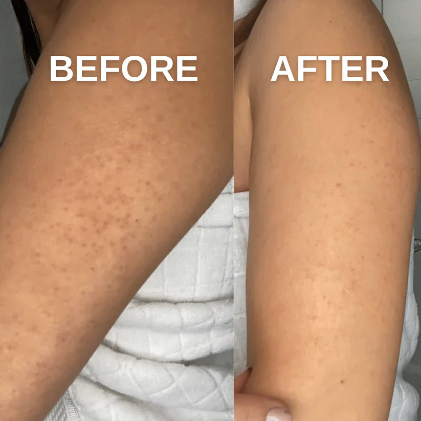 Exfoliating Mitt
