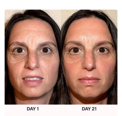 ReNeck™ Face massager