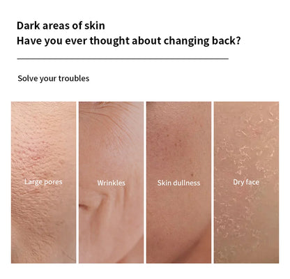 GlowLift™ Collagen Masks