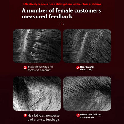 Red Light Hair Rejuvenation Scalp Massager